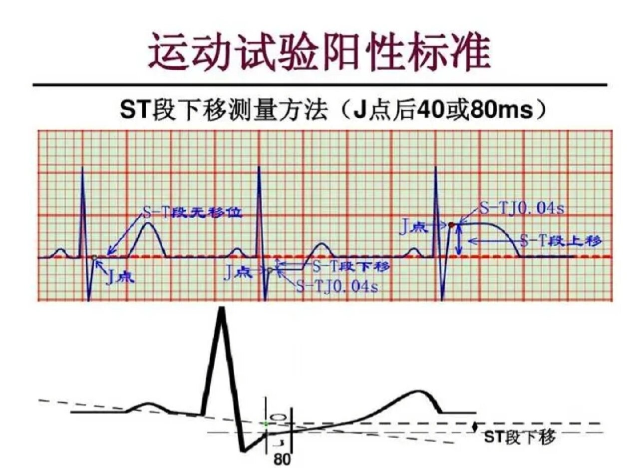 最近更新_智能设备_运动_汽车_智慧出行频道_天极网(图1)