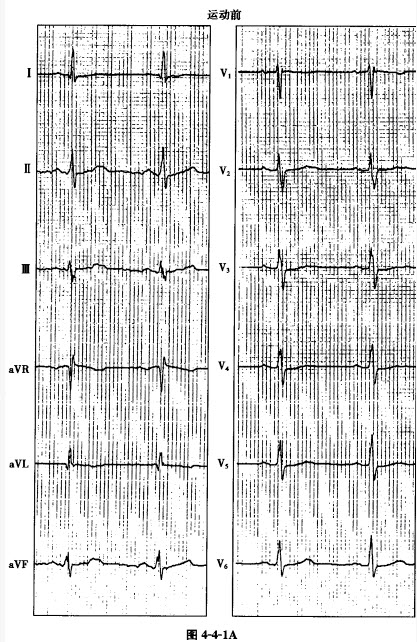 报名启动！2026宁德市环东湖健康跑——用脚步绘就新春的健康篇章(图1)