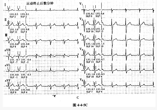 @宁德人新春第一跑来啦！报名参加还可免费玩这些A级旅游景区(图1)