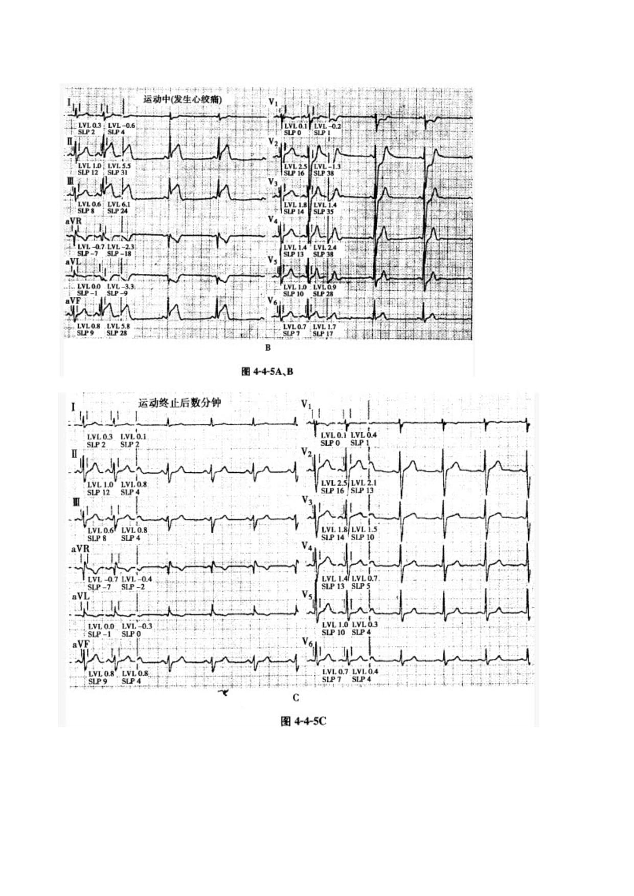 2026年智能运动手表对比测评：KPEP、Garmin、AppleWatch、Fitbit谁是你的最佳运动伙伴？(图1)