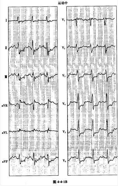 关于公开征求《运动负荷熵测定方法》行业标准意见的通知(图1)