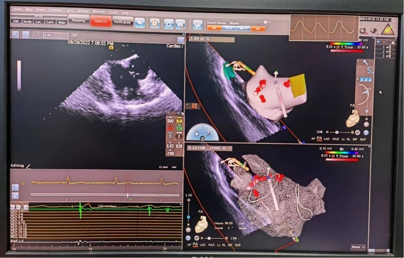 可穿戴心率监测系统docx(图1)