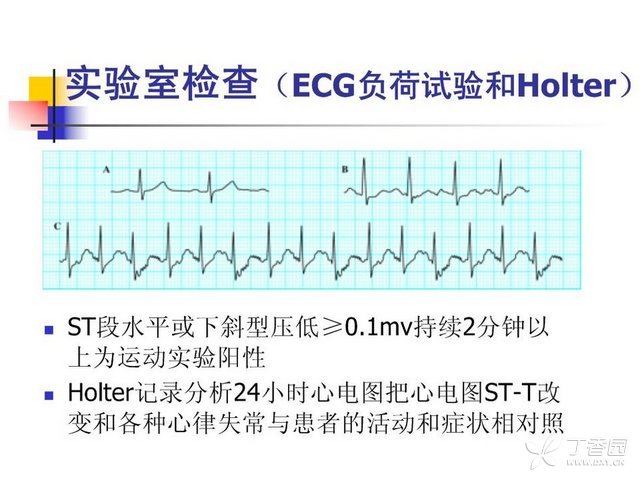 2026宜宾马拉松报名指南（时间+入口+费用+要求）(图1)