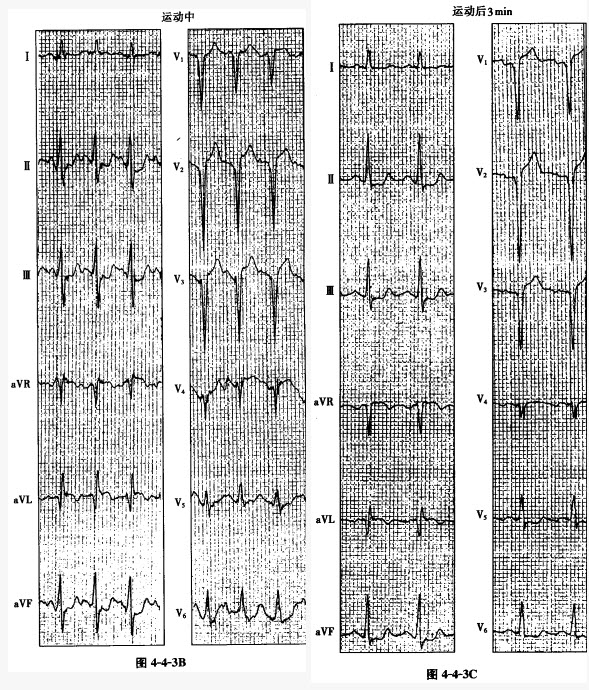 @“跑友”们:运动健康记“心”上全程防护有指南!(图1)