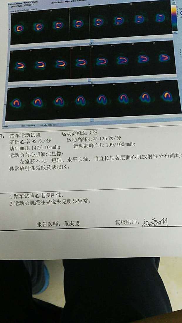 心电图运动负荷试验检查过程-有来医生(图1)